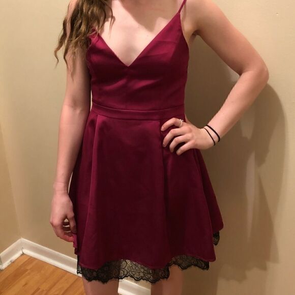 Lover + friends dress - Picture 5 of 8